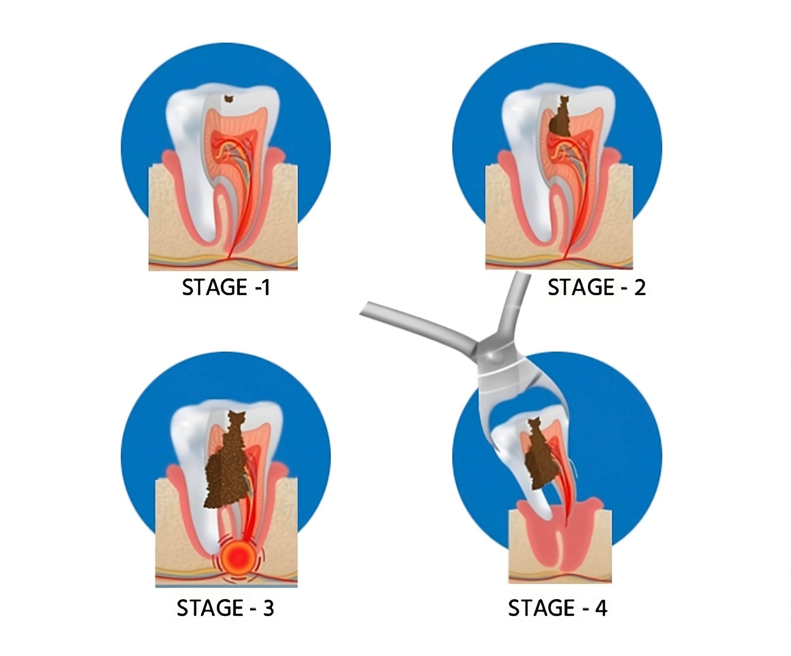 Best skilled experienced Dentist Performing Tooth Extraction Surgery in Scarborough