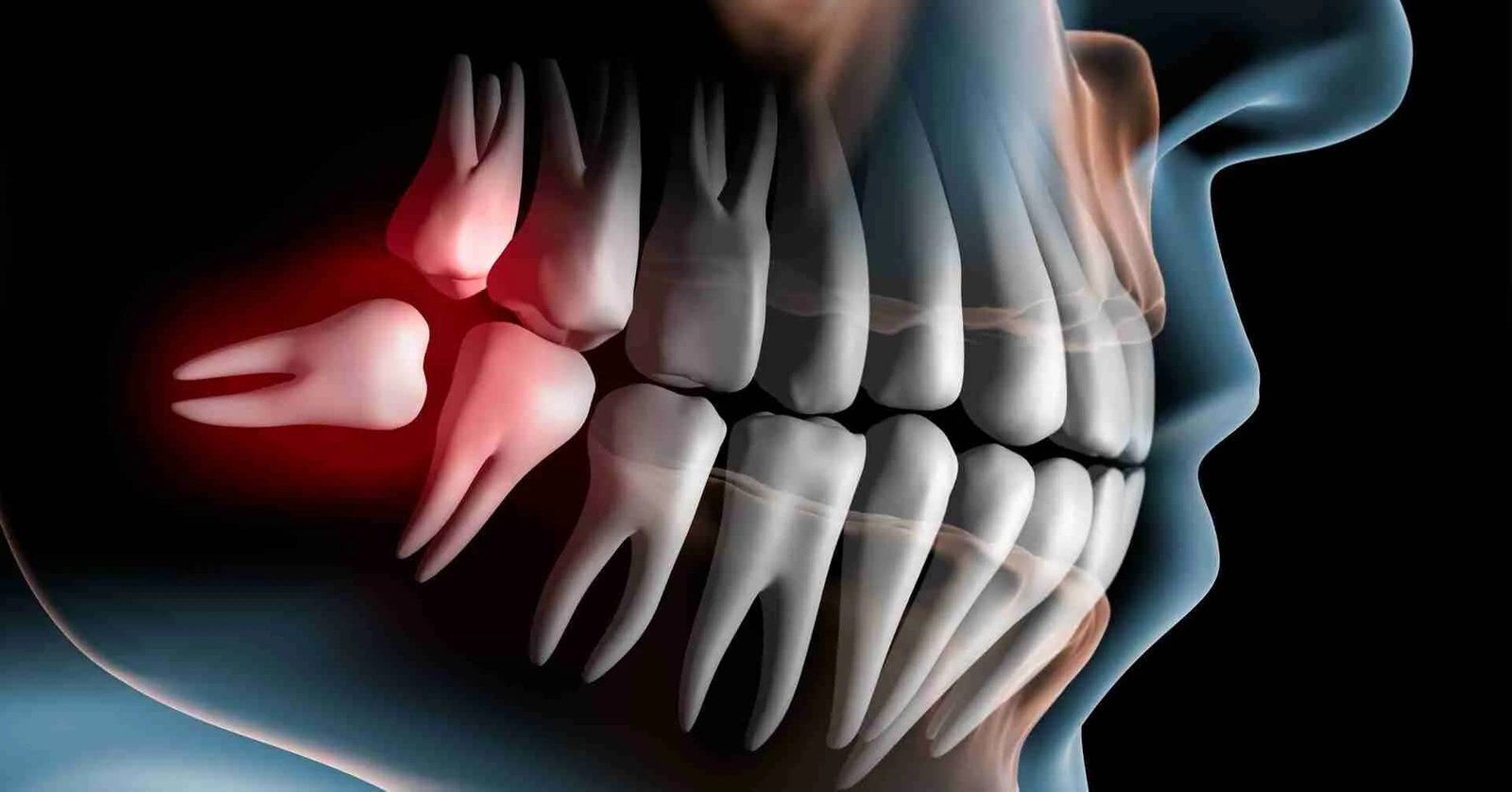 Experienced Oral Surgeon for Wisdom Teeth Removal in Scarborough