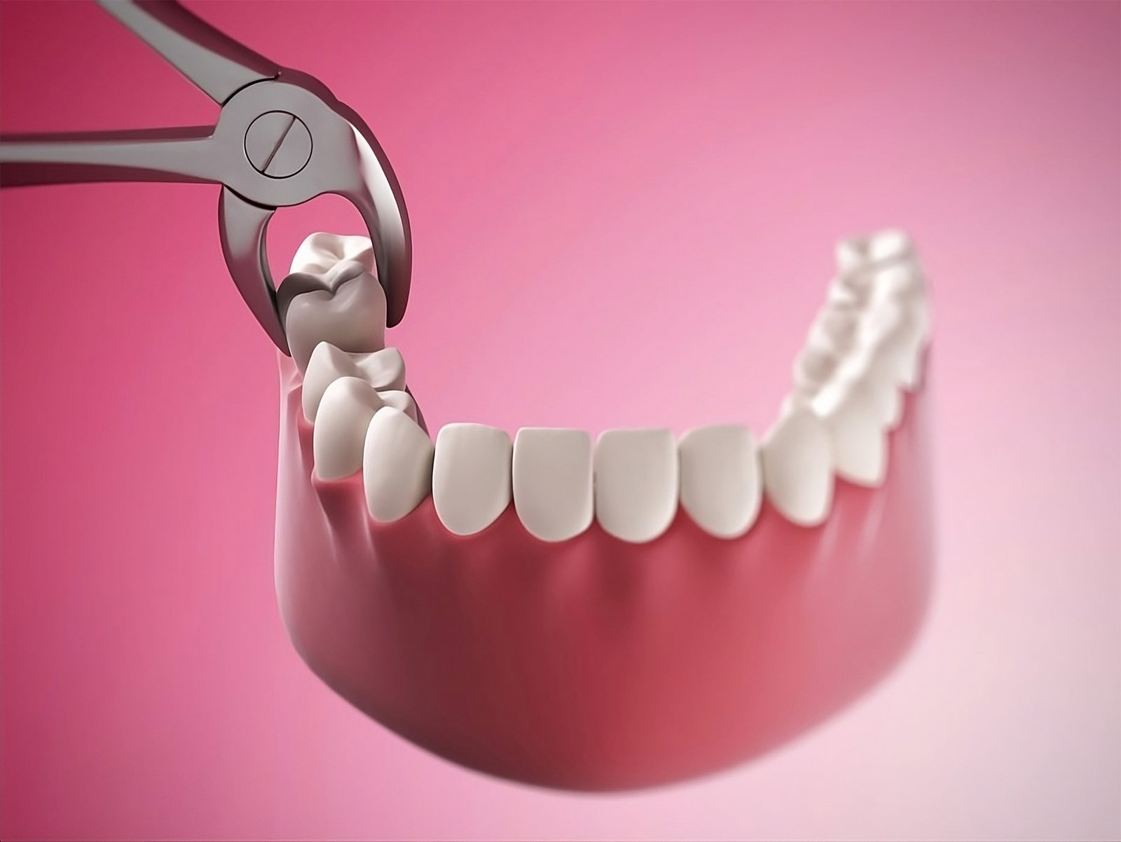 Painless Dental Extraction Surgery at Maral Dental Clinic in Scarborough